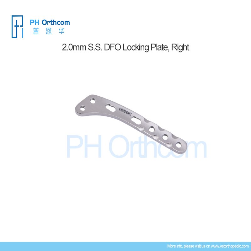 121-007-2034R, 2.0mm DFO Locking Plate Right-1